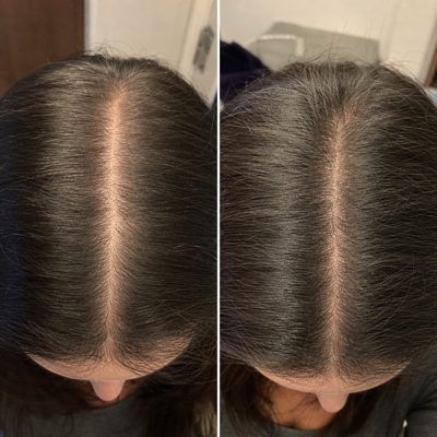 Brooke's part from above, wide at first, then narrower with new hairs at ten weeks