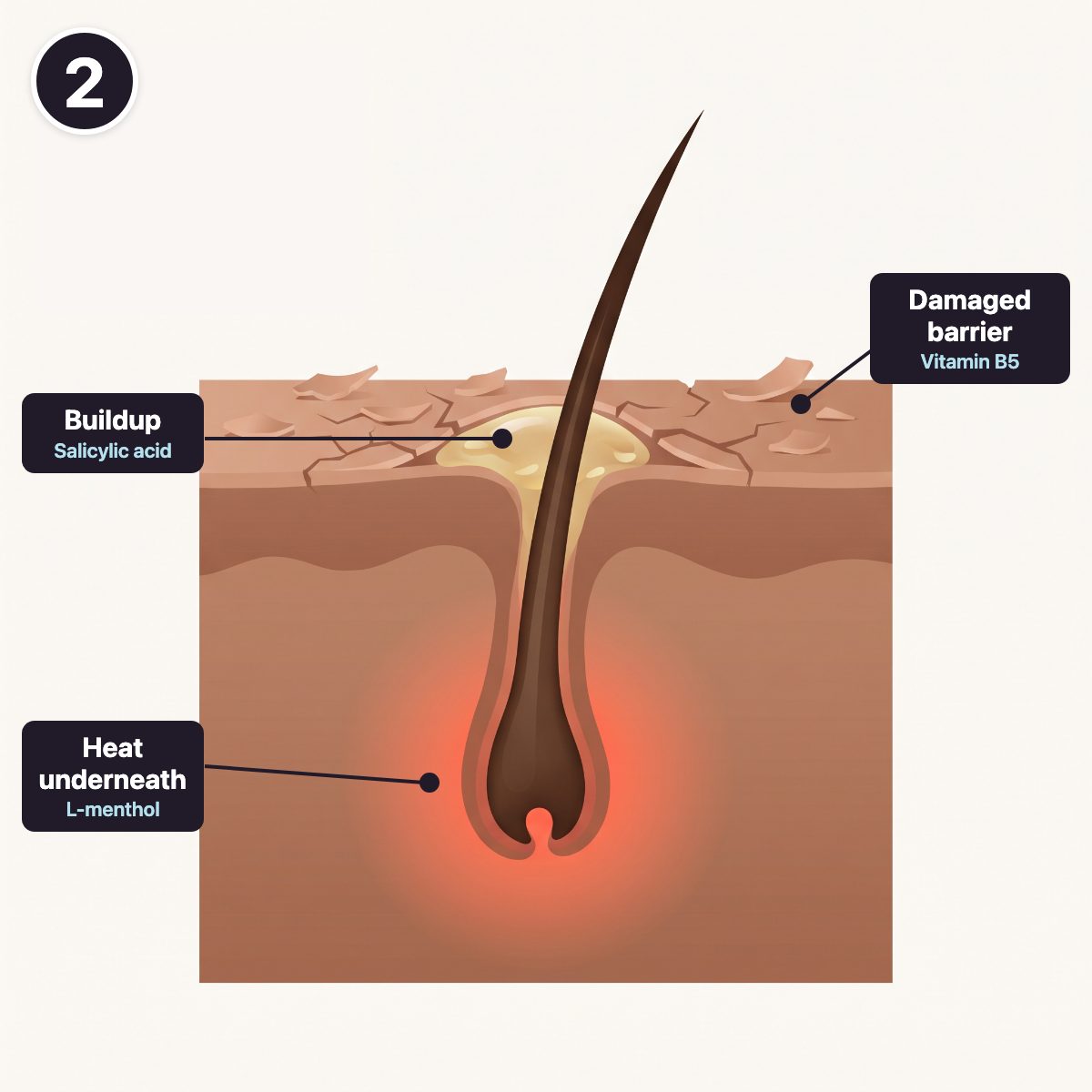 The three things keeping a scalp inflamed: buildup in the follicle, a damaged barrier and heat underneath